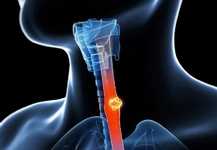 Yemek Borusu Anatomisi Nasıldır?